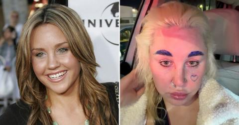 split image of Amanda Bynes and Amanda Bynes