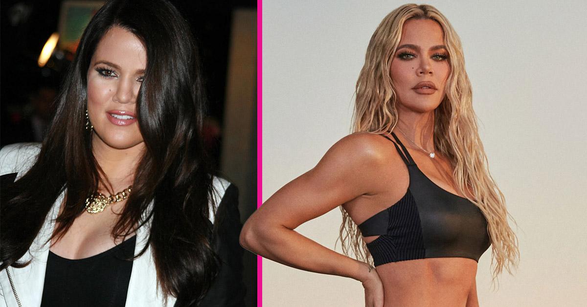 Experts Analyze Khloé Kardashian's Dramatic Transformation As Before And After Photos Fuel Multiple Nose Job Speculation