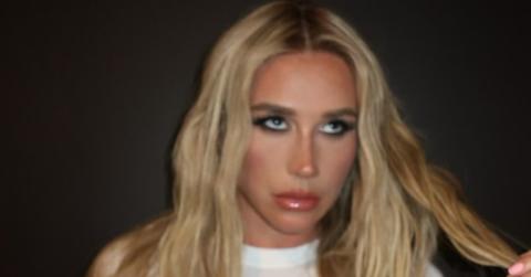 Photo of Kesha.