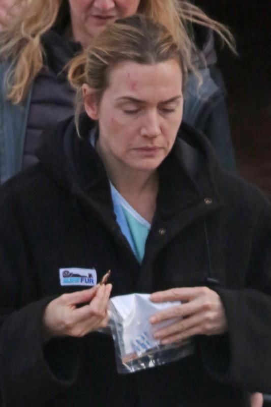 *EXCLUSIVE* A bruised Kate Winslet finishes scenes at the hospital