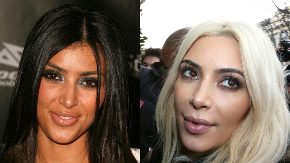 kim kardashian plastic surgery before and after