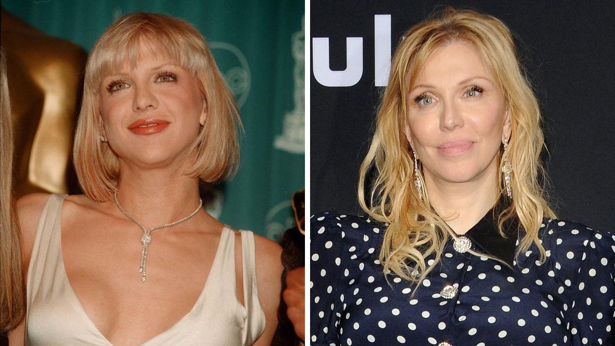 celebrities who got facelifts before after photos