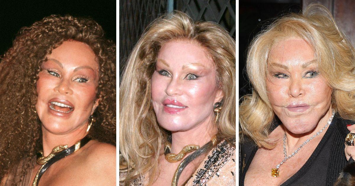 jocelyn wildensteins transformation gallery