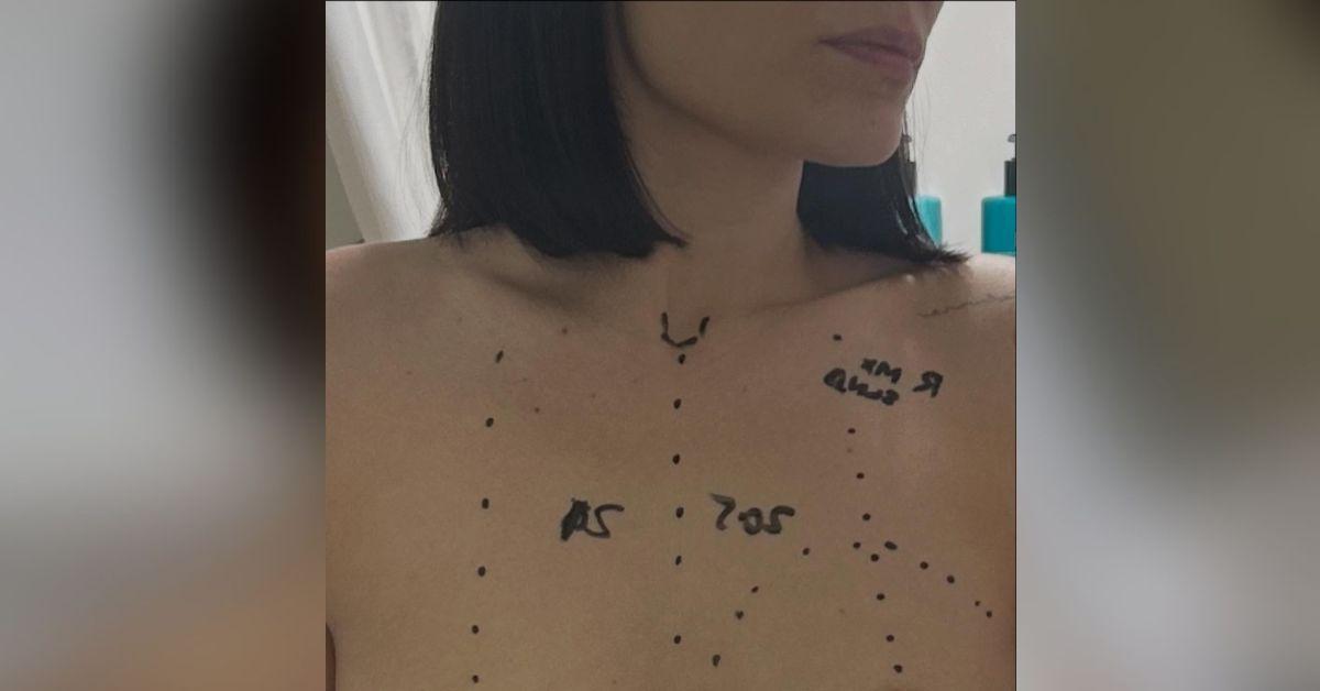 jessie j raw photos hospital cancer surgery waiting results