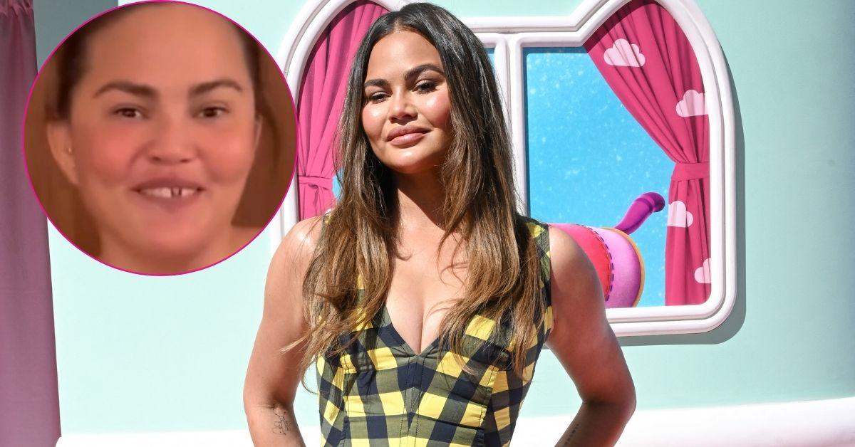 Photo of Chrissy Teigen