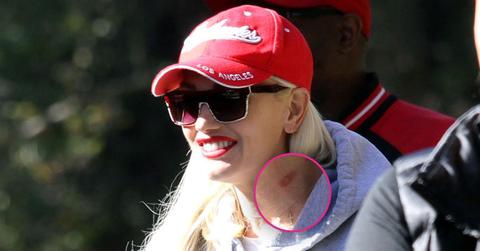 Gwen stefani hickey neck 08