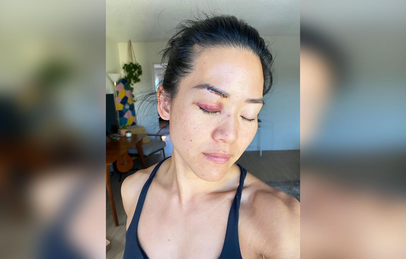 former survivor fiji star michelle yi stabbed and beaten by a homeless woman who had attacked three others ok