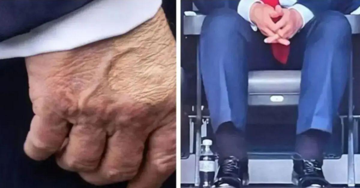 image of Congresswoman Sydney Kamlager-Dove claims the president may be taking Leqembi.