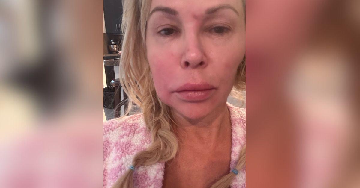 brandi glanville new face parasite