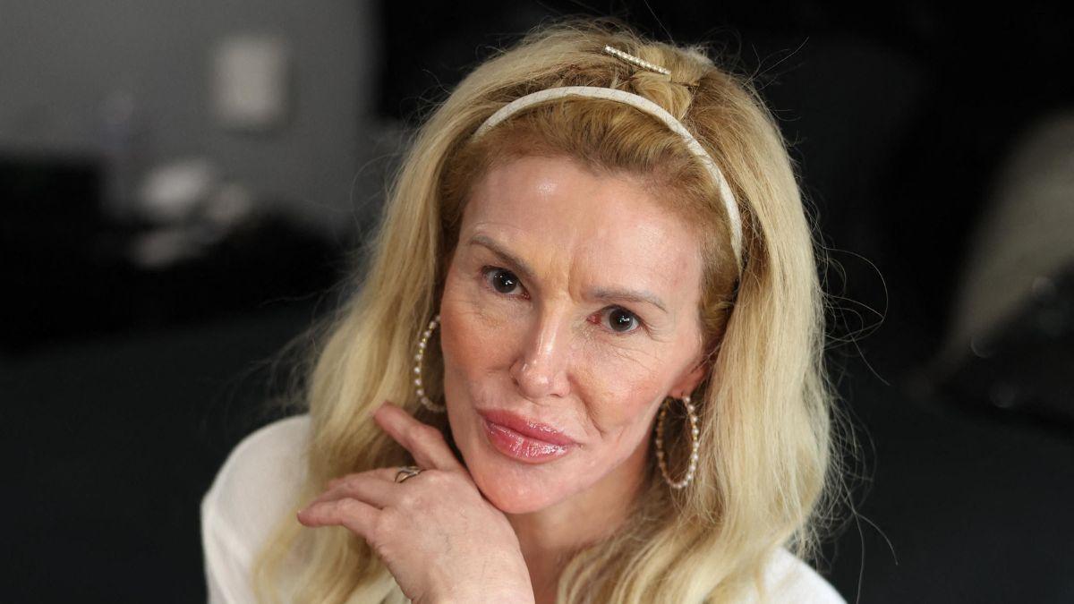 Image of Brandi Glanville opened up about the emotional toll of living with unexplained facial paralysis.