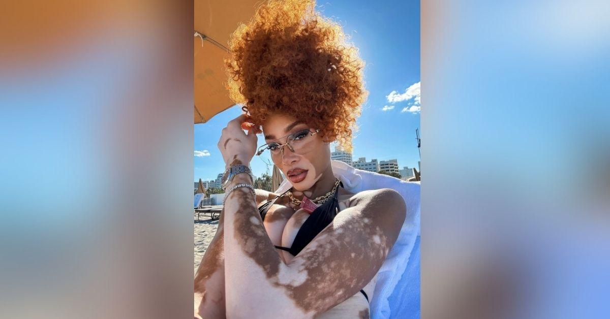 cay skin winnie harlow sunscreen