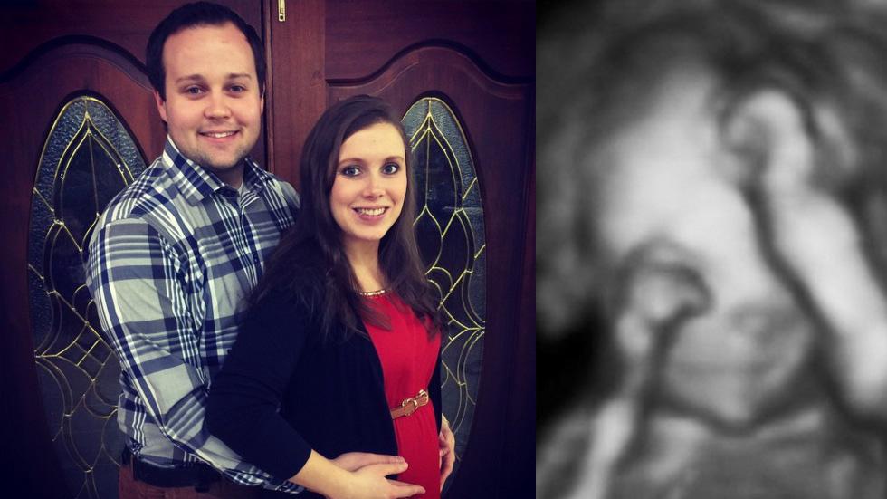 Josh duggar anna pregnant expecting rehab 01