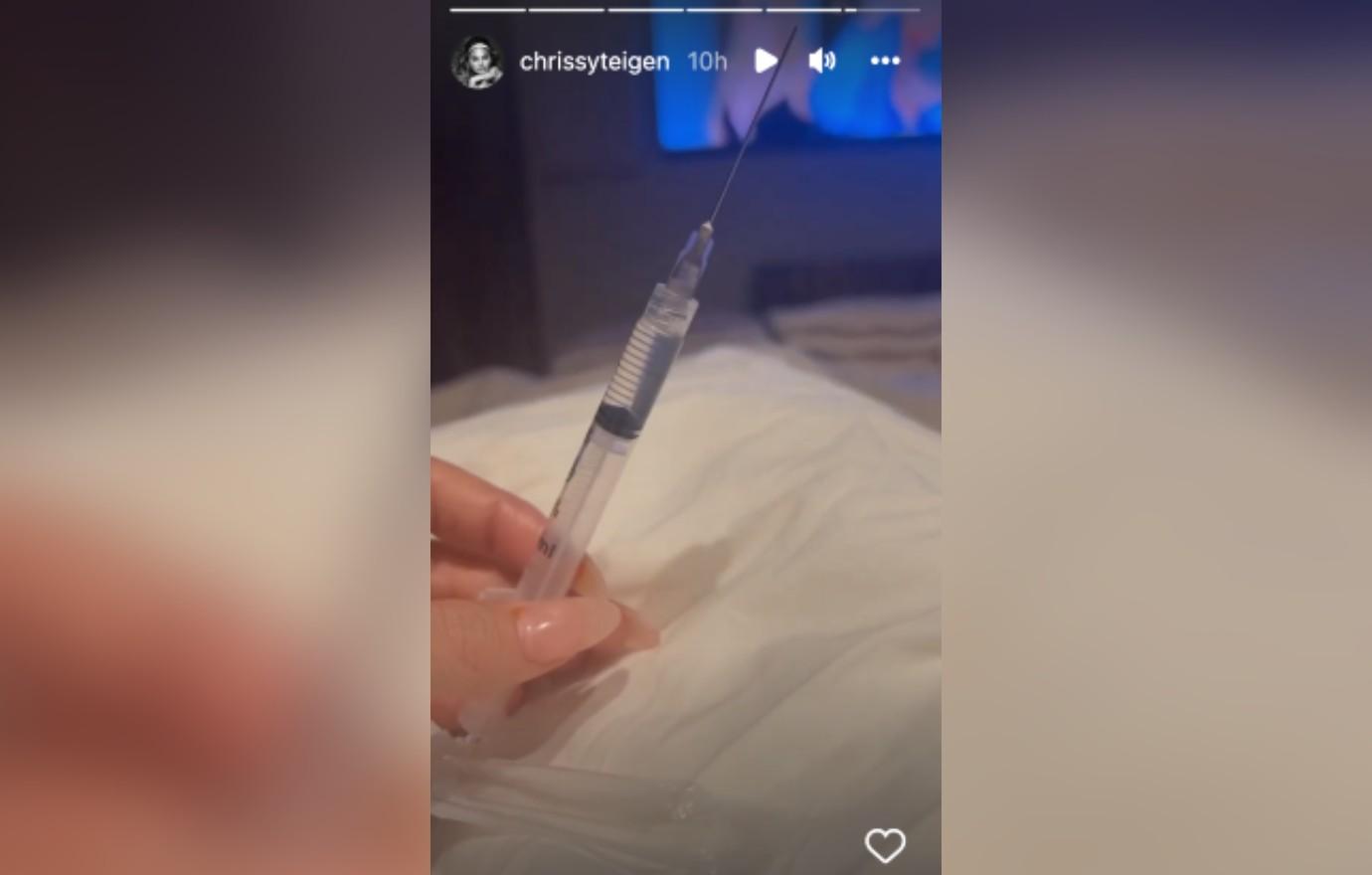 Chrissy Teigen Talks IVF, Says She's 'Good' At Giving Herself Shots