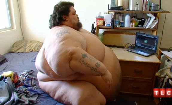//_pound_man_video_struggles_lose_weight_surgery_stack_