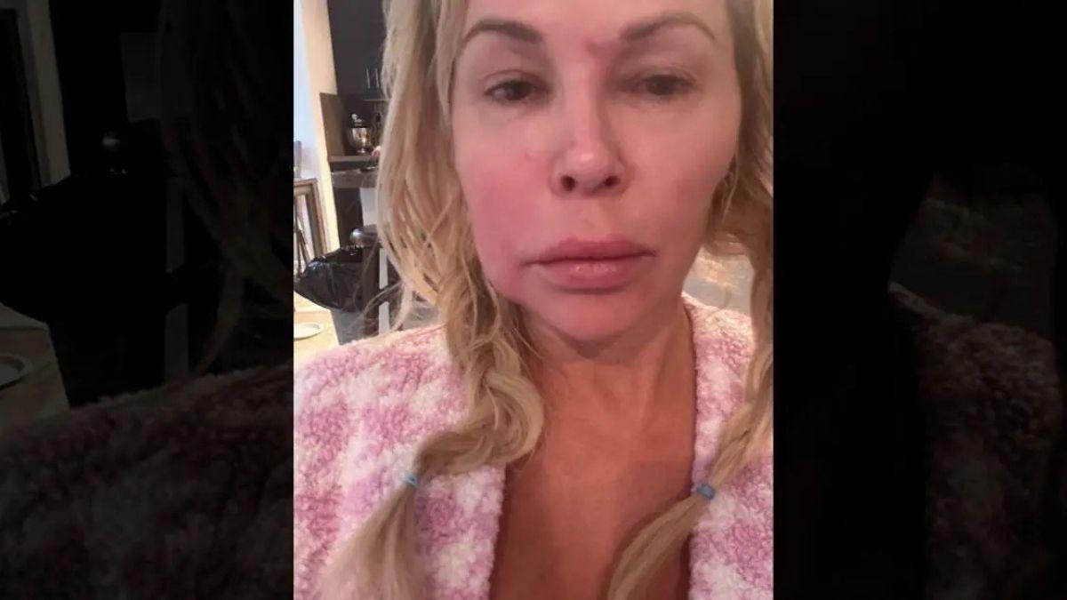 Photo ofBrandi Glanville publicly revealed her condition in December 2024.