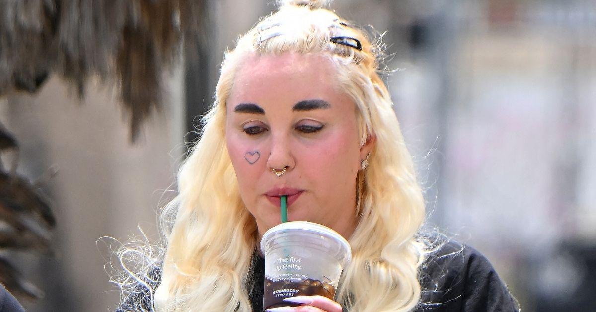 image of The 'Easy A' alum recently got lip injections and blepharoplasty surgery.