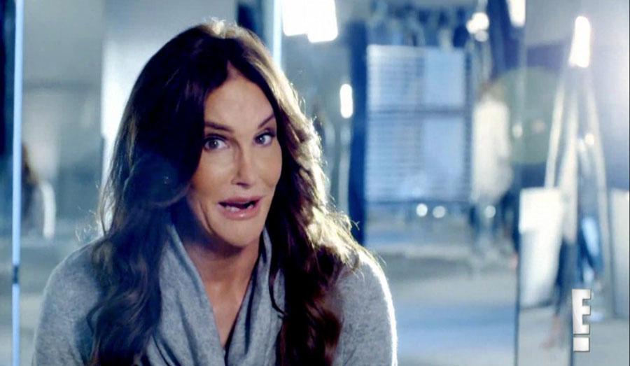 Caitlyn jenner plastic surgery