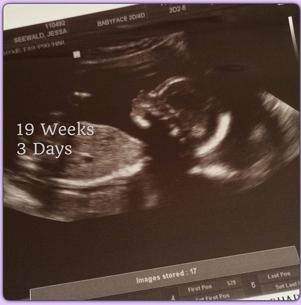 Jessa seewald ultrasound