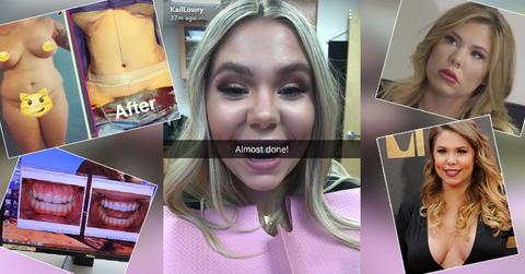 Kailyn Lowry plastic surgery trasformation before and after include teeth, lip fillers, tummy tuck, breast augmentation, butt lift and other procedures