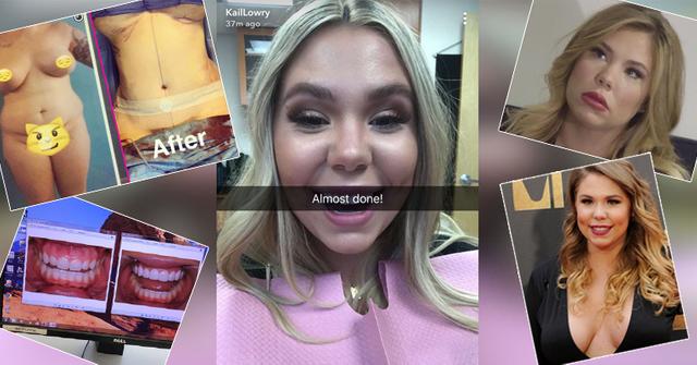 Kailyn Lowry plastic surgery trasformation before and after include teeth, lip fillers, tummy tuck, breast augmentation, butt lift and other procedures