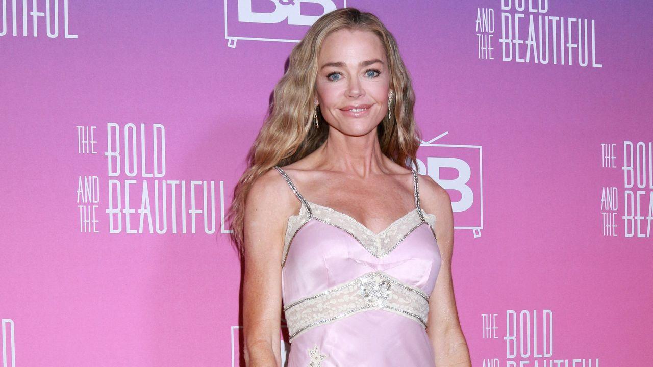 Denise Richards Details the ‘Roughest’ Part of Facelift Recovery After Undergoing Multiple Procedures
