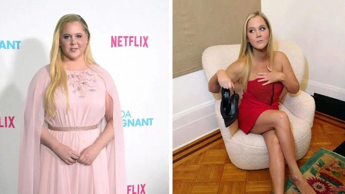Photo of Amy Schumer said posting photos of her thinner frame is 'a celebration of life and health — not a cry for help.'