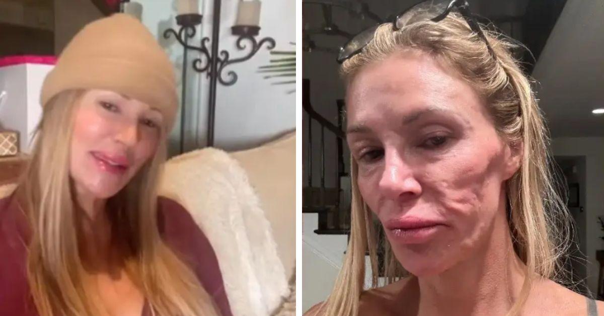 image of Brandi Glanville connected with two women experiencing similar symptoms and said all three have a history of extensive dental work.