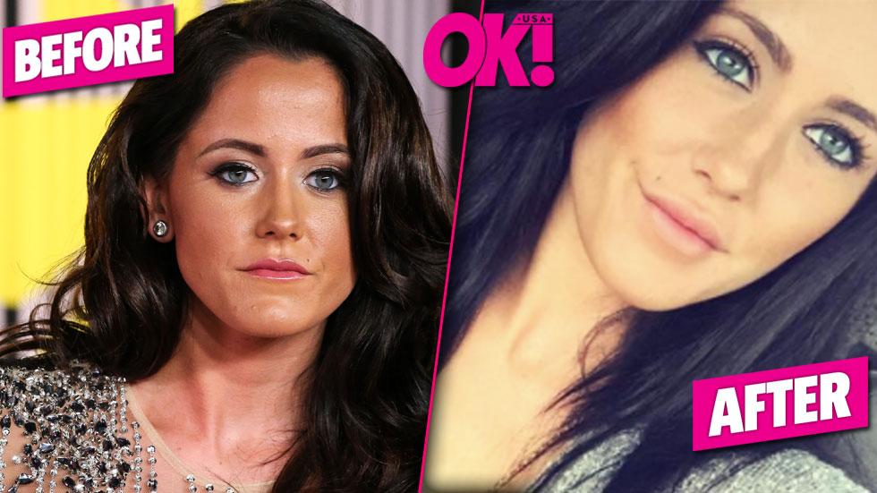Ok Exclusive The Next Farrah Abraham Teen Mom 2 Star Jenelle Evans Receives Lip Injections 