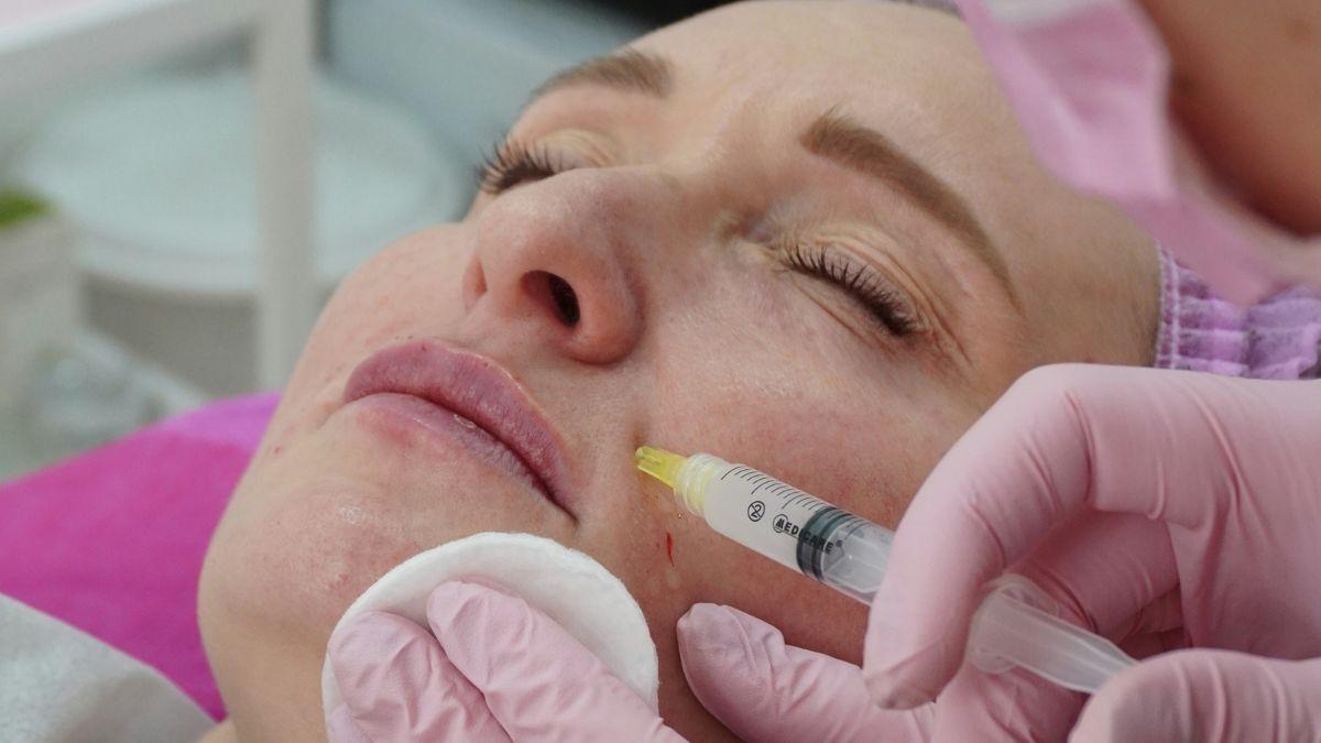 Image of Surgeons reportedly discovered lingering filler years after injections.