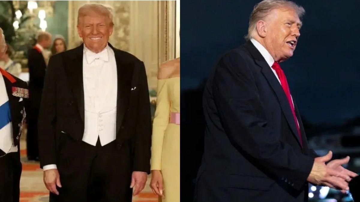 image of Donald Trump blamed the marks on his daily aspirin use.