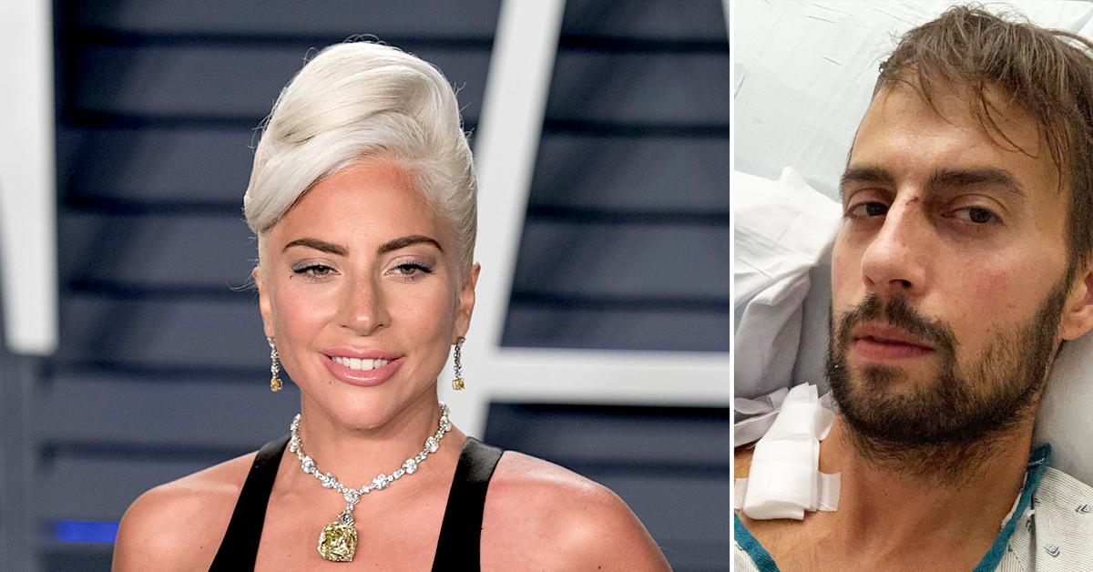 lady gaga dog walker ryan fischer opens up healing shot emotional