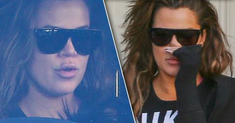 Khloe kardashian lip injections