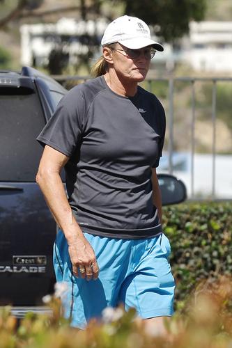 From Breast Implants To Shaved Legs: Check Out Bruce Jenner’s 10 Top