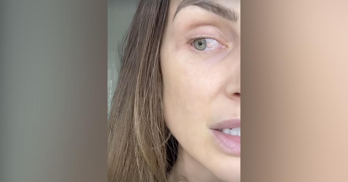 lala kent undergoing biopsy eye discoloration pre cancer