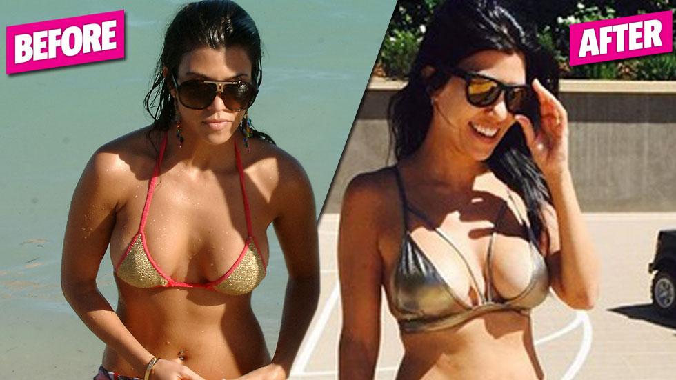 Kourtney kardashian boob job plastic surgery breakup scott