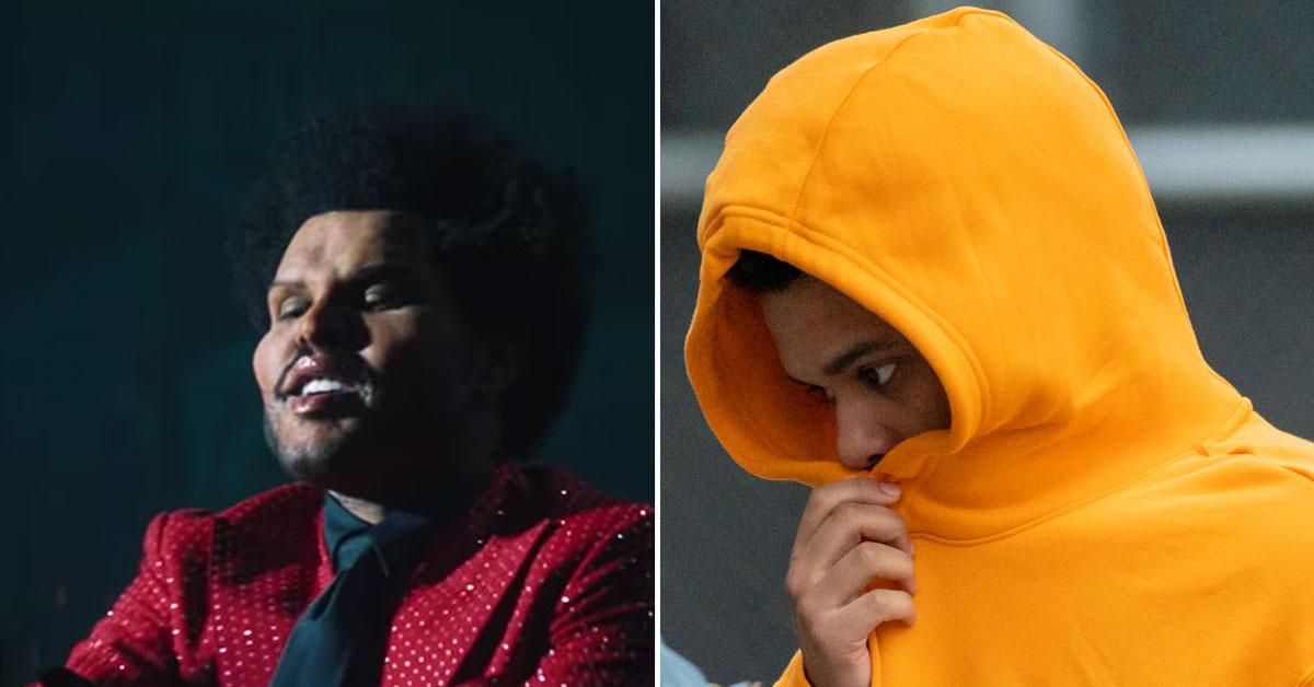 The Weeknd's True Face Is Finally Revealed After Plastic Surgery ...