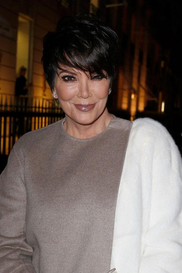 Kris jenner plastic surgery4