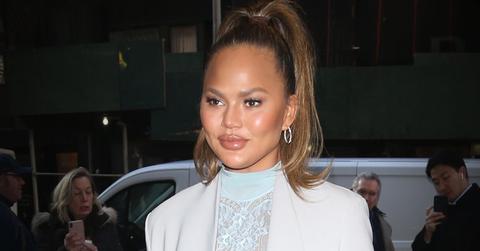 Chrissy Teigen Uses Botox To Help Her Migraines While Pregnant