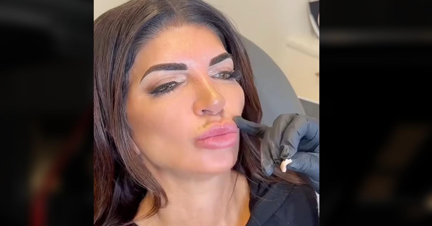 teresa giudice trying more natural look dissolves lip fillers receiving backlash