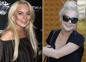 Lindsay lohan teeth oct19newsbt 01.jpg
