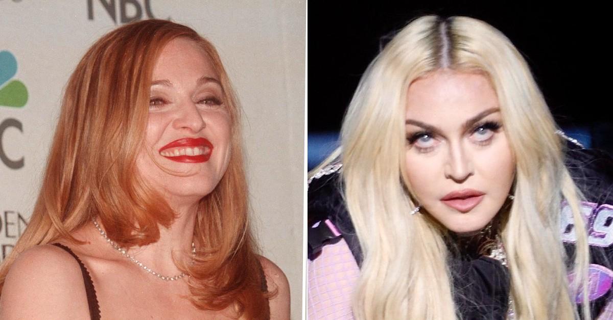 What Plastic Surgery Has Madonna Gotten? See Singer's Transformation