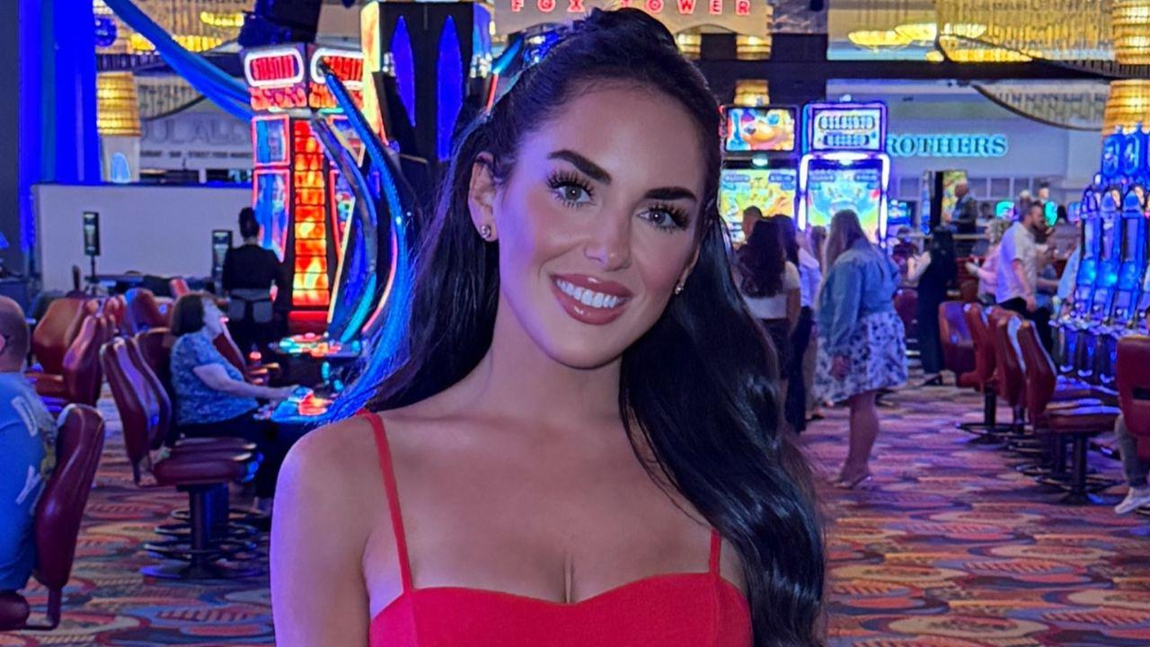 image of Rosie Woods DiMare revealed she regularly receives Botox, annual lip filler, and previously tried chin and jaw filler.