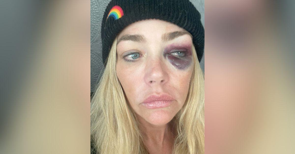 image of Aaron Phypers denied abusing the actress and said she had an affair.