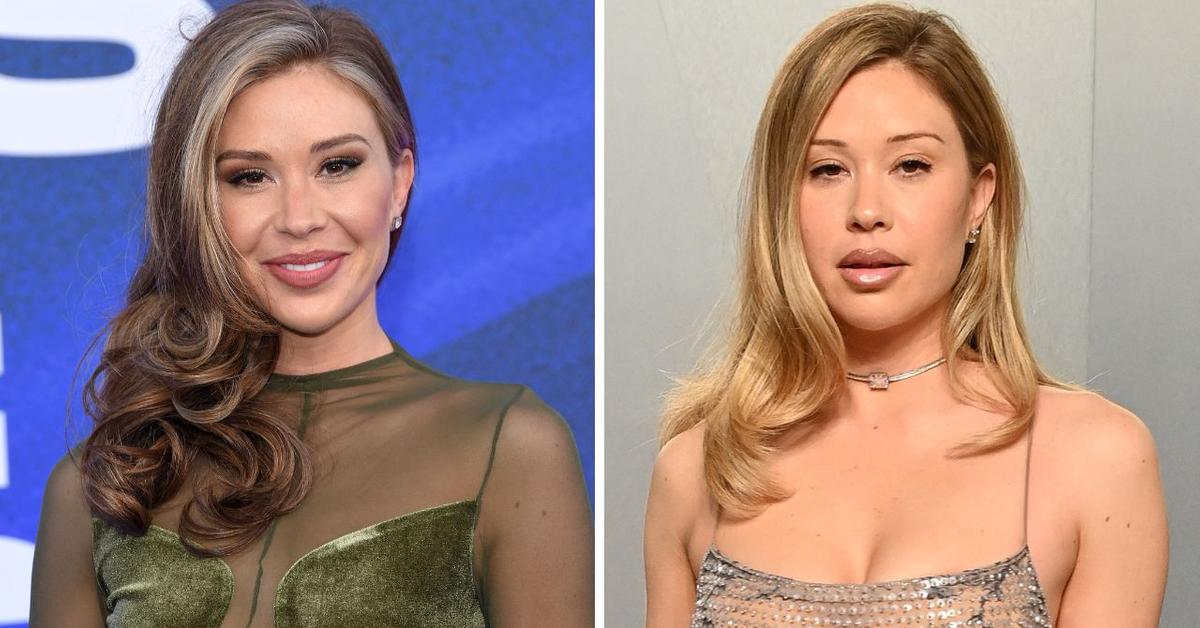 Has Gabby Windey Had Plastic Surgery? Inside the 'Bachelorette' Star's Transformation