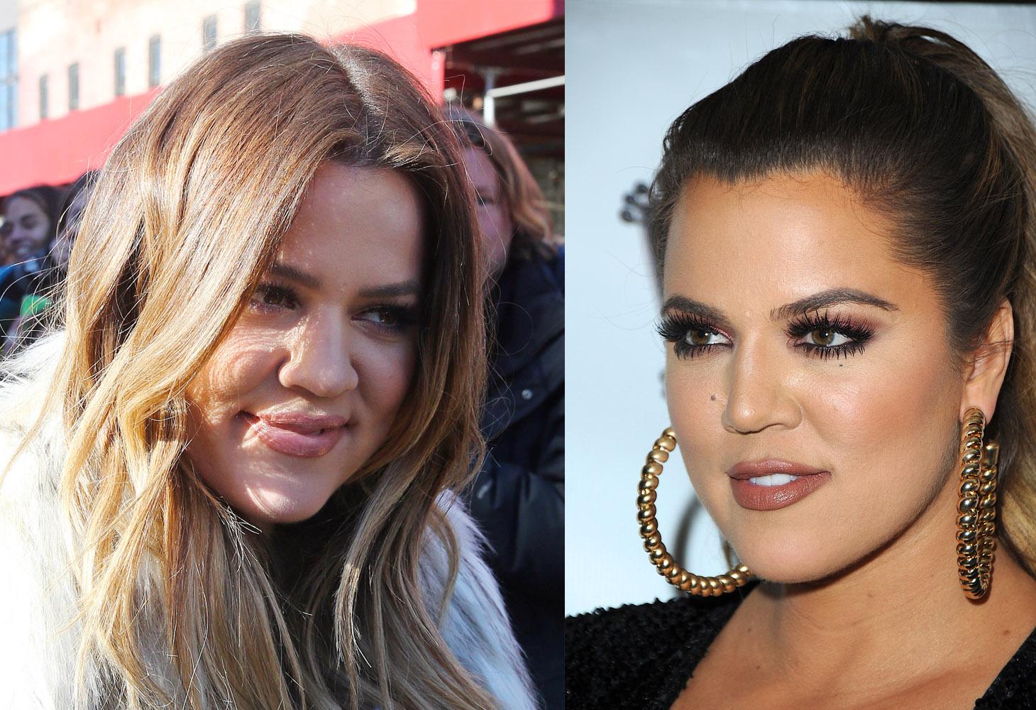 6 khloe kardashian trout pout SPL