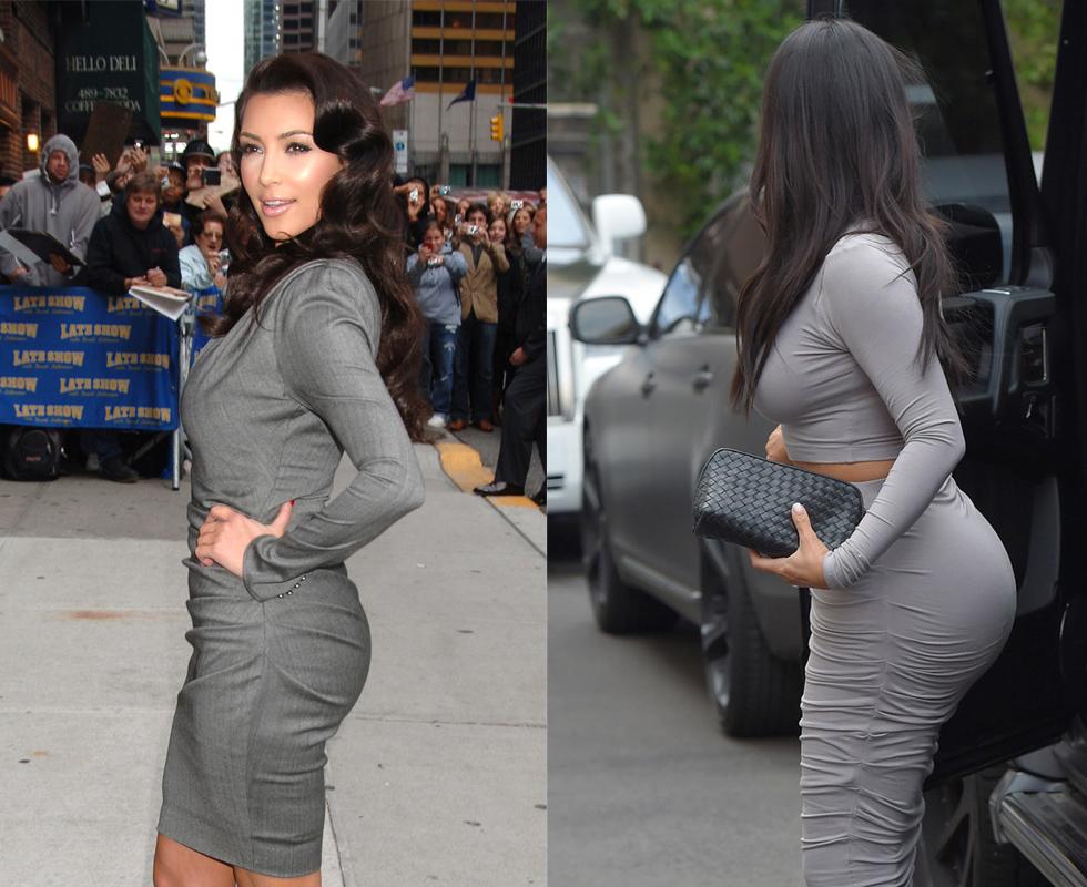 Kim Kardashian Butt Plastic Surgery Before And After