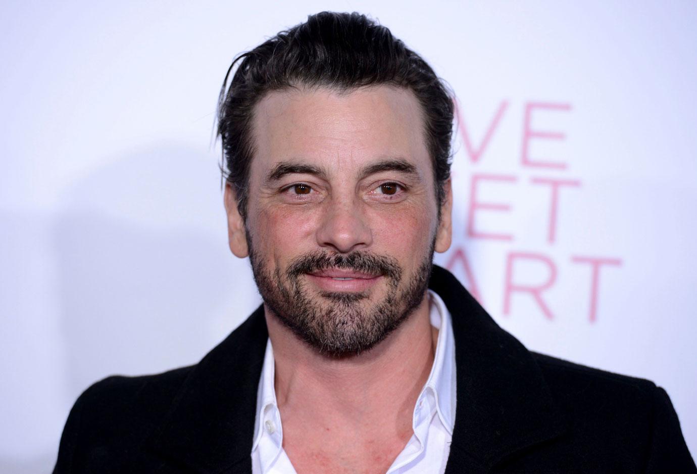 Skeet Ulrich Shares Gruesome Photo On Instagram From His Open Heart Surgery