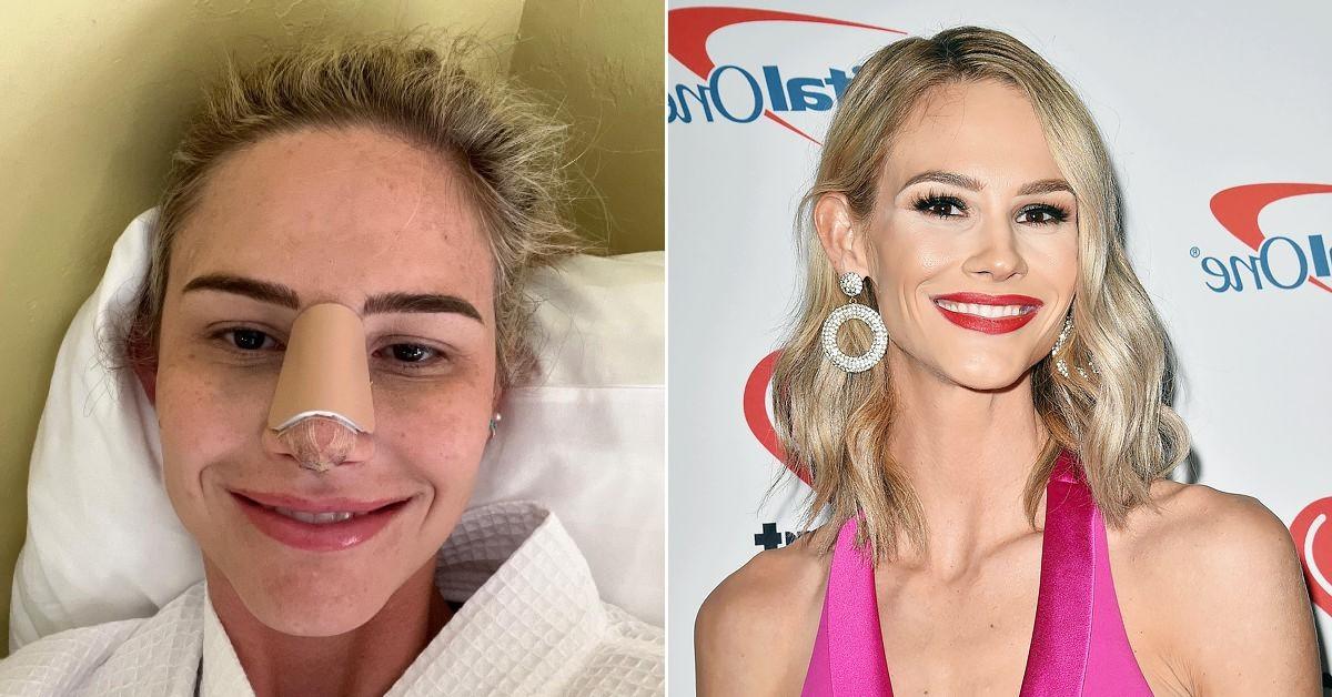 Meghan King Posts Photos After Plastic Surgery For Chest & Nose