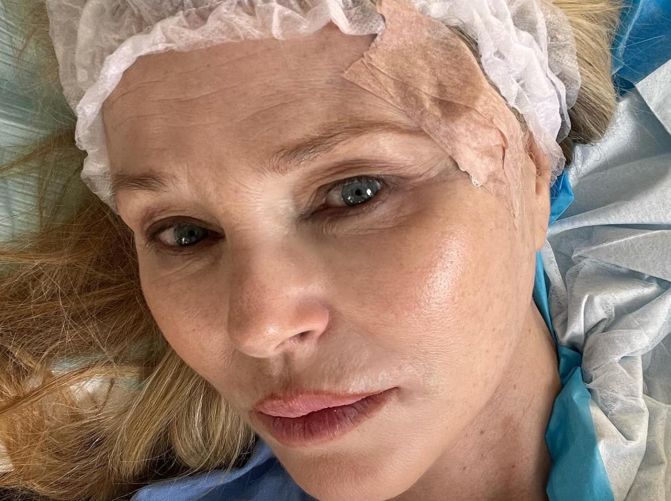 christie brinkley skin cancer face discovered doctors visit child