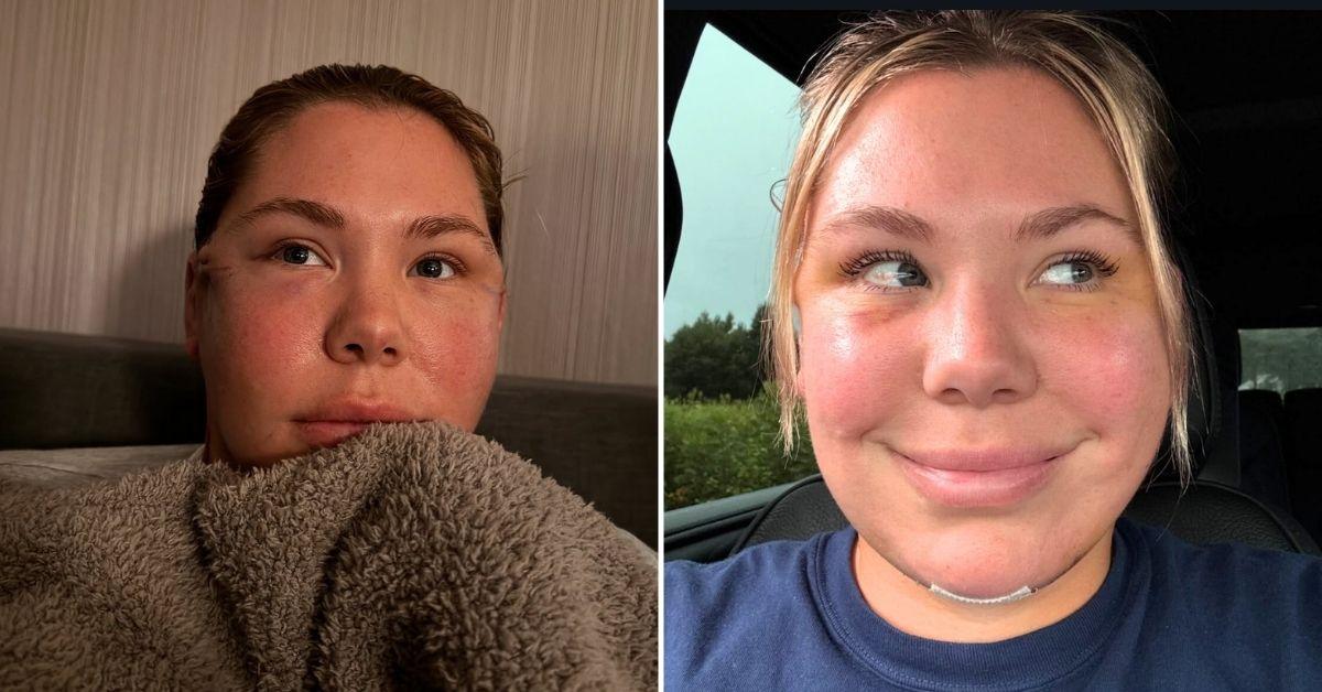 photo of Kailyn Lowry said she might have to undergo the same surgery again in 20 years